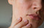 Understanding and treating dry skin: The science behind hydration