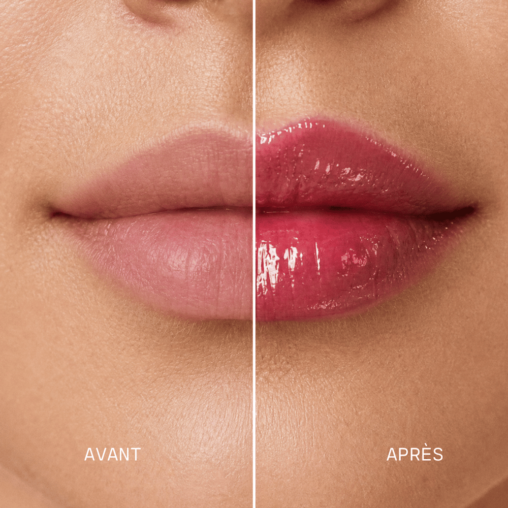 Peptide Lip Kit